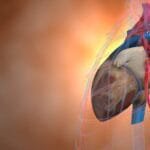 What is the best way to clean out clogged arteries?