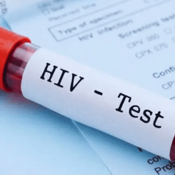 HIV
