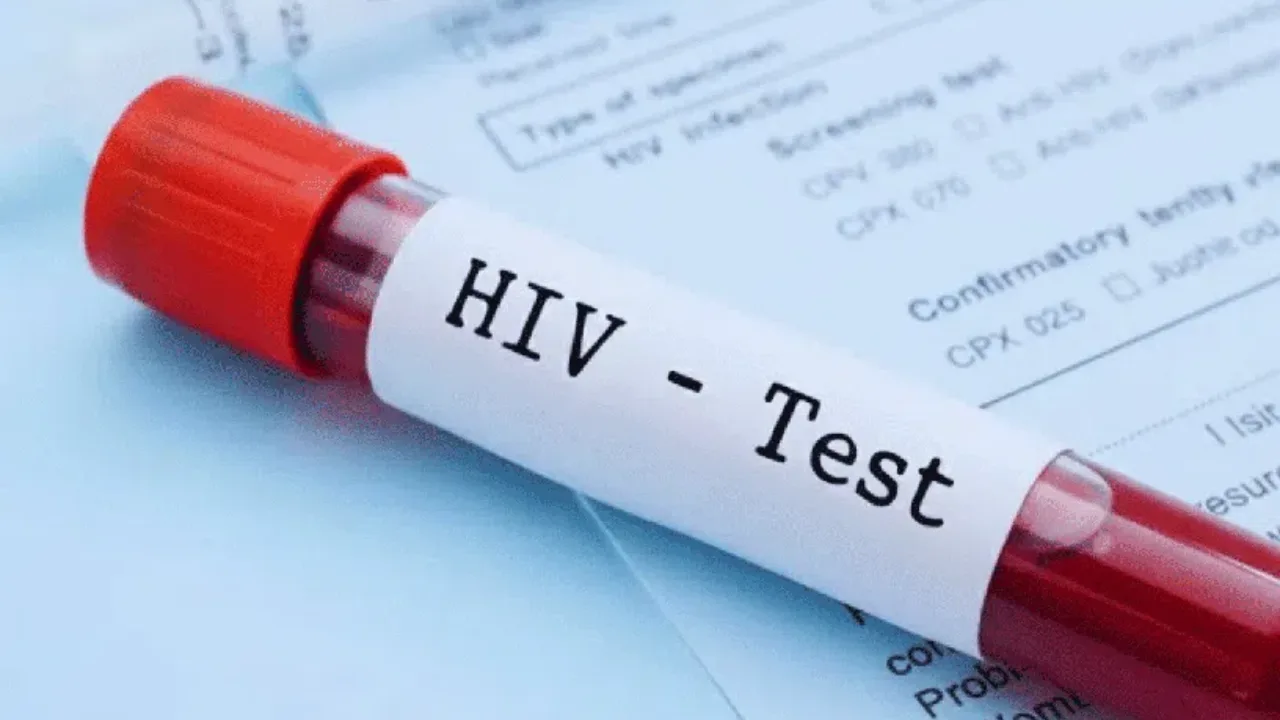 HIV